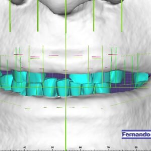 3D Aesthetic Guidelines: Smile Creator 8mm by Fernando Polanco